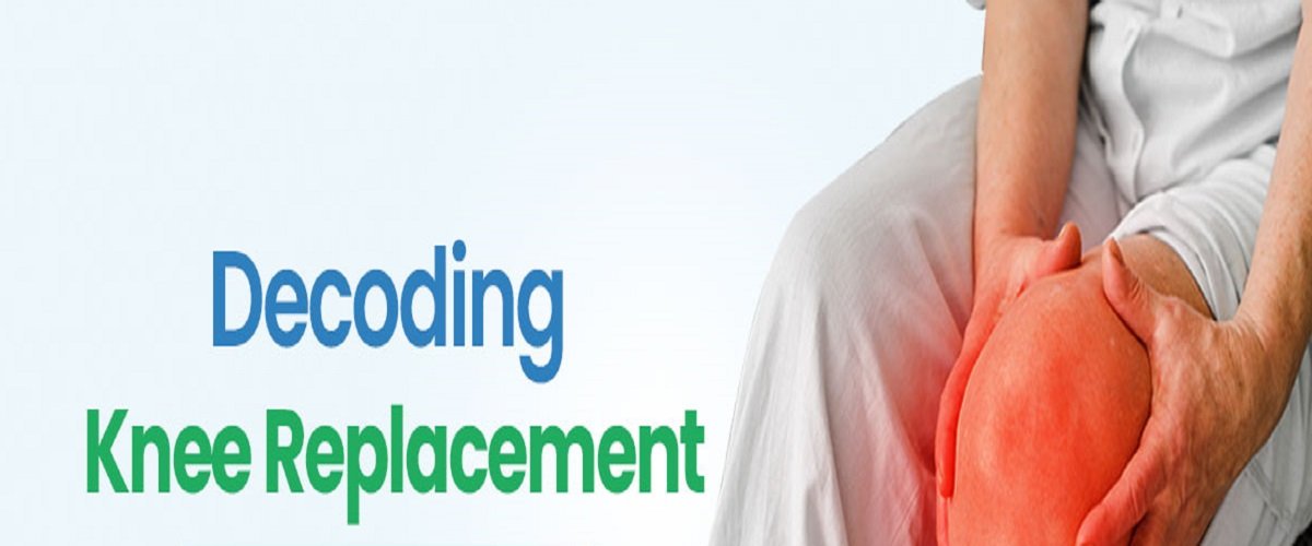 Decoding The Knee Replacement Surgery Cost In Noida